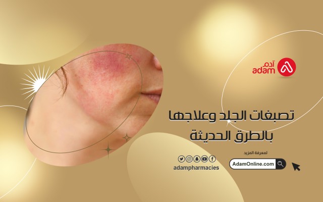 تصبغات الجلد وعلاجها بالطرق الحديثة